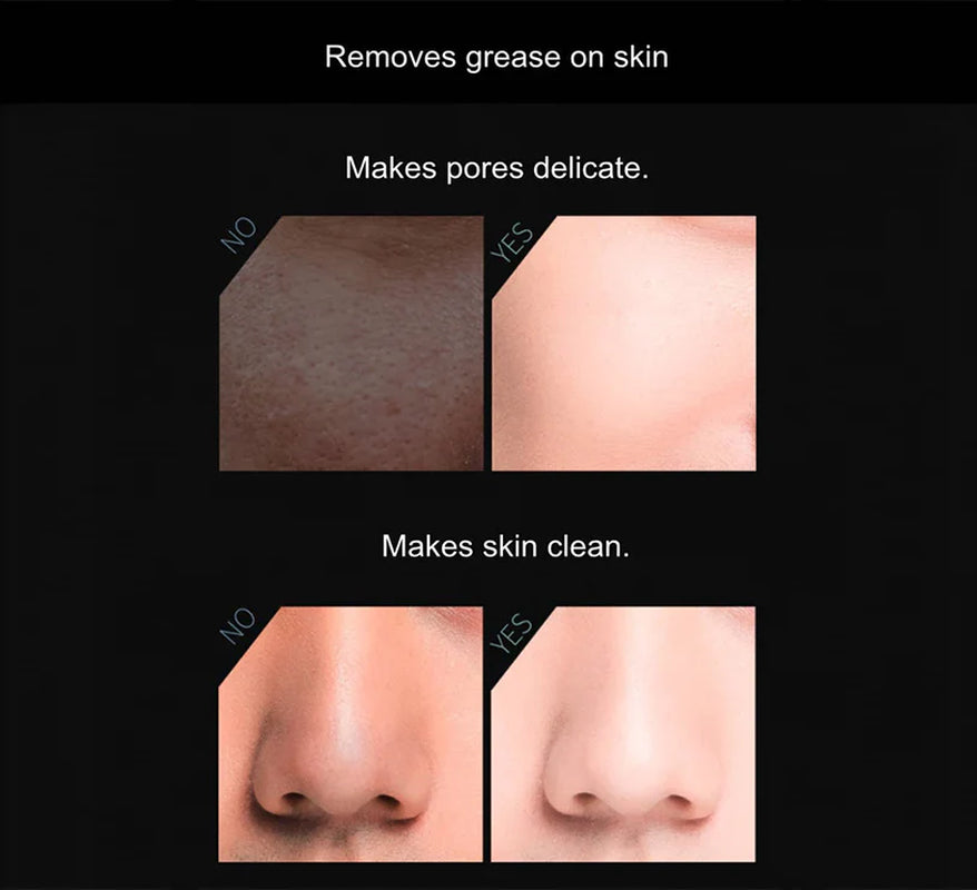 Experience Flawless Skin with Our Volcanic Stone Oil-Absorbing Face Roller